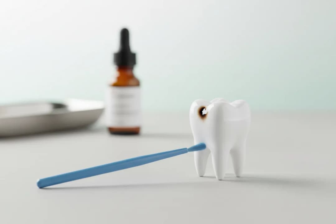 7 Common Questions About Silver Diamine Fluoride in Kids’ Dentistry